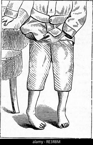 . Un texte-livre de physiologie animale, avec des chapitres d'introduction sur la biologie générale et un traitement complet de la reproduction ... La Physiologie, comparatif. 42 D. APPLETON &AMP ; rendez-vous:8 SAYRB ILLUSTRÉ. Des conférences sur la chirurgie orthopédique et les maladies des articulations. Par Lewis A. Satee, M. D., professeur de chirurgie orthopédique et de chirurgie clinique à l'hôpital Bellevue Medical College ; Consulting chirurgien à l'Hôpital Bellevue, l'hôpital Charité, etc., etc. Deuxième édition, revue et considérablement augmentée. 324 illustrations. 8vo. 569 pages. Tissu, $5.00 ; moutons, 6.00 $. Cette édition a été complètement revu et rearr Banque D'Images