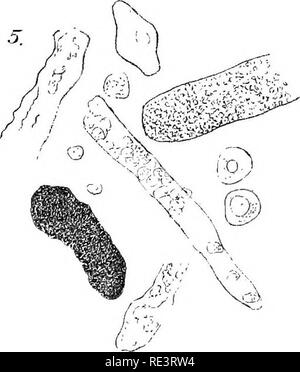 . Rapport spécial sur les maladies des bêtes . Les bovins. X215. Veuillez noter que ces images sont extraites de la page numérisée des images qui peuvent avoir été retouchées numériquement pour plus de lisibilité - coloration et l'aspect de ces illustrations ne peut pas parfaitement ressembler à l'œuvre originale.. United States. Bureau of Animal Industry ; Atkinson, C. T. (Vickers T. ), d. 1891. Washington : Govt. L'impression. L'arrêt. Banque D'Images