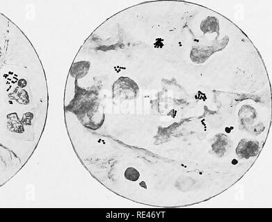 . L'hématologie et de bactériologie clinique pour les praticiens. Bactériologie, Hématologie. Fig. 3. Fig.. Veuillez noter que ces images sont extraites de la page numérisée des images qui peuvent avoir été retouchées numériquement pour plus de lisibilité - coloration et l'aspect de ces illustrations ne peut pas parfaitement ressembler à l'œuvre originale.. Emery, Walter d'Este. Londres, Lewis Banque D'Images