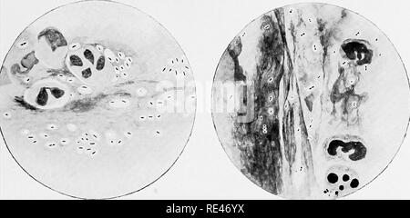 . L'hématologie et de bactériologie clinique pour les praticiens. Bactériologie, Hématologie. Â j'^ si / Fig. I. Fig. 2.. Fig. 3. Fig.. Veuillez noter que ces images sont extraites de la page numérisée des images qui peuvent avoir été retouchées numériquement pour plus de lisibilité - coloration et l'aspect de ces illustrations ne peut pas parfaitement ressembler à l'œuvre originale.. Emery, Walter d'Este. Londres, Lewis Banque D'Images