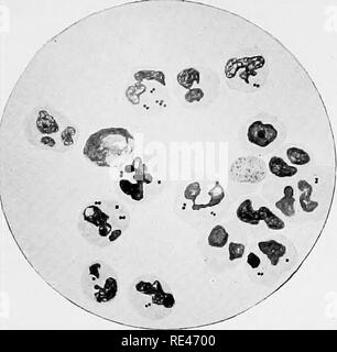 . L'hématologie et de bactériologie clinique pour les praticiens. Bactériologie, Hématologie. III. LA PLAQUE. Â j'^ si / Fig. I. Fig. 2.. Veuillez noter que ces images sont extraites de la page numérisée des images qui peuvent avoir été retouchées numériquement pour plus de lisibilité - coloration et l'aspect de ces illustrations ne peut pas parfaitement ressembler à l'œuvre originale.. Emery, Walter d'Este. Londres, Lewis Banque D'Images