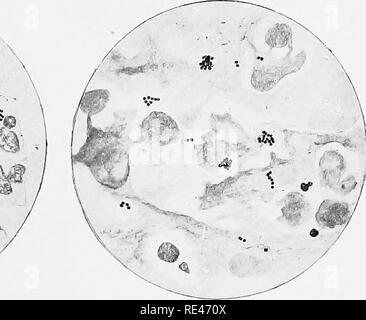 . L'hématologie et de bactériologie clinique pour les praticiens. Bactériologie, Hématologie. Fig. 3. Fig.. Fig. 5. Fig. 6.. Veuillez noter que ces images sont extraites de la page numérisée des images qui peuvent avoir été retouchées numériquement pour plus de lisibilité - coloration et l'aspect de ces illustrations ne peut pas parfaitement ressembler à l'œuvre originale.. Emery, Walter d'Este. Londres, Lewis Banque D'Images