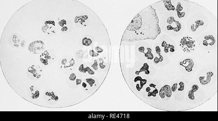 . L'hématologie et de bactériologie clinique pour les praticiens. Bactériologie, Hématologie. Dans la plaque.. Fig. I. Fig. 2.. Veuillez noter que ces images sont extraites de la page numérisée des images qui peuvent avoir été retouchées numériquement pour plus de lisibilité - coloration et l'aspect de ces illustrations ne peut pas parfaitement ressembler à l'œuvre originale.. Emery, Walter d'Este. Londres, Lewis Banque D'Images