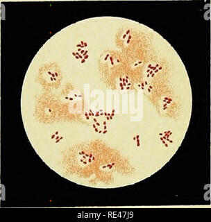 . Bactériologie appliquée ; un manuel d'introduction à l'usage des étudiants, des médecins hygiénistes, des analystes et des techniciens. La bactériologie. 79. 80.. 81. LithAist FReichWd Muiictei.T.... Veuillez noter que ces images sont extraites de la page numérisée des images qui peuvent avoir été retouchées numériquement pour plus de lisibilité - coloration et l'aspect de ces illustrations ne peut pas parfaitement ressembler à l'œuvre originale.. Pearmain, Thomas Hames ; Moor, Cresacre George. Londres, Baillie ?re, Tindall et Cox Banque D'Images