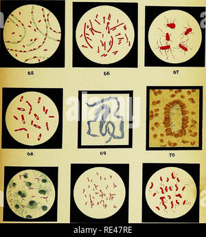 . Bactériologie appliquée ; un manuel d'introduction à l'usage des étudiants, des médecins hygiénistes, des analystes et des techniciens. La bactériologie. 71 72 73 Lith.aist T. T Eeiclihold, Miinchen.. Veuillez noter que ces images sont extraites de la page numérisée des images qui peuvent avoir été retouchées numériquement pour plus de lisibilité - coloration et l'aspect de ces illustrations ne peut pas parfaitement ressembler à l'œuvre originale.. Pearmain, Thomas Hames ; Moor, Cresacre George. Londres, Baillie ?re, Tindall et Cox Banque D'Images