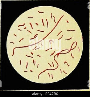 . Bactériologie appliquée ; un manuel d'introduction à l'usage des étudiants, des médecins hygiénistes, des analystes et des techniciens. La bactériologie. 59. 60. 61 LittUtasl ReicWiold Miiiictieii X F.,. Veuillez noter que ces images sont extraites de la page numérisée des images qui peuvent avoir été retouchées numériquement pour plus de lisibilité - coloration et l'aspect de ces illustrations ne peut pas parfaitement ressembler à l'œuvre originale.. Pearmain, Thomas Hames ; Moor, Cresacre George. Londres, Baillie ?re, Tindall et Cox Banque D'Images