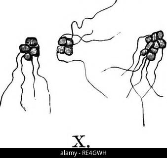 . Atlas et principes de bactériologie et texte-livre de diagnostic bactériologique spécial. La bactériologie. Planche 6. Micrococcus luteus. Ferd. Cohn, amendée par Lehm. et de Neum. I. La gélatine stab, six jours à 22°. II. Plaque de gélatine, trois jours à 22°. X 50. À gauche, superficielle ; à droite, une colonie. III. Préparation microscopique. X 1000. À partir d'un deux jours-'-ancienne plaque de gélose. Souvent les micrococci sont regroupés en tétrades. IV. Plaque de gélose, cinq jours à 22°. La taille naturelle. Les colonies sont parfois plus jaune. La culture de pommes de terre V., six jours à 22°. Parfois, il dispose d'un mat. Sarcina pulmonum. Virch Banque D'Images