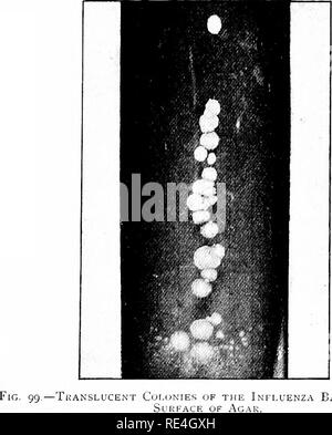 . Les micro-organismes et la maladie. Une introduction à l'étude de certains micro-organismes. Les micro-organismes. Bacilles pathogènes ; groupe C 265 est gonflé jusqu'à un ballon ovale ou sphérique, beaucoup de fois plus épais que l'élément typique ; le nombre de ces éléments élargie est plus grande en plus tard que dans les cultures récentes, et les plus importantes d'entre elles font souvent preuve d'une vacuole dans leur centre ou sur un côté. À partir de ces faits, il est probable que ces éléments sont des formes involution élargie.. Un Magnifiud bacilles ENZA tiil deux fois. Préparations faites des colonies cultivées sur la surface de la gélose ou Agar glycérine show Banque D'Images