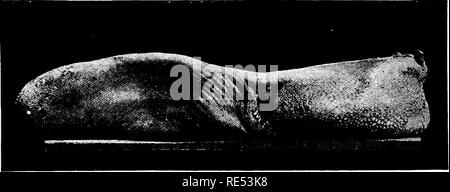 . Pathologie spéciale et la thérapeutique des maladies d'animaux domestiques. La médecine vétérinaire. 650 l'Actinomycose. de l'abondance du tissu fibreux niaj' causer la destruction de l'actinomyces et ainsi parvenir à une récupération spontanée. Tissu conjonctif lâche dans l'occasion, en général, en particulier chez le porc, mais aussi dans l'homme, il y a lieu l'émigration d'un grand nombre de leucocytes dans les navires en raison de l'irritation produite par le parasite. Par la suite, de vastes zones du tissu entourant les nodules subissent l'adoucissement, devenue purulente anastomosé avec d'autres domaines semblables et Banque D'Images