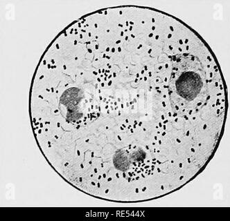 . Pathologie spéciale et la thérapeutique des maladies d'animaux domestiques. La médecine vétérinaire. ]^26 Peste porcine. création de l'étiologie de la maladie de cette dernière (voir cette maladie) il a été prouvé que chez les porcs touchés avec le virus de la peste porcine filtrables le bacillus bipolaire produit habituellement seulement les processus secondaires, de sorte que ces cas devraient être considérés comme la peste porcine. La sur-estimation de l'importance de la forme ovoïde bacilles bipolaire étant présent dans les tissus des poumons touchés ont causé beaucoup de se connecter avec cette maladie chronique la pneumonie catarrhale de porcs que les cal Banque D'Images