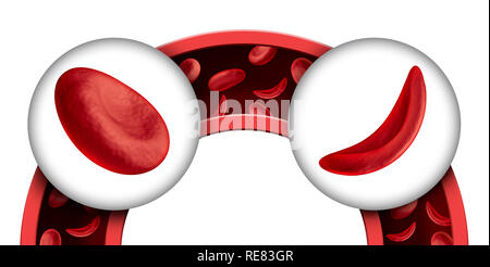 La drépanocytose comme une maladie du sang rouge comme une hémoglobine normale et anormale des illustrations médicales anatomie concept dans un rendu 3D. Banque D'Images