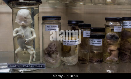 Exposition scientifique des stades de développement de l'embryon humain. La pièce principale est un foetus avorté âgé de 5 mois. La salle d'histoire naturelle. Banque D'Images