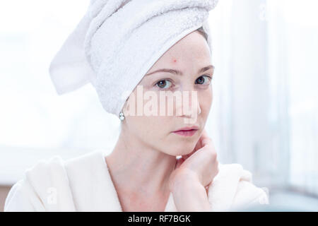 Belle jeune femme malheureuse avec une serviette sur la tête à la recherche à l'acné sur son visage. Concept d'hygiène et de soins pour la peau Banque D'Images