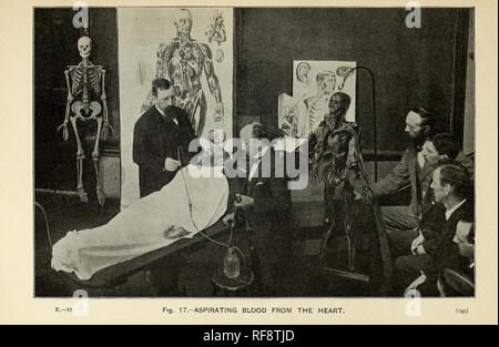 Vintage photographie victorienne de chercheurs médicaux et médecins d'étudier un cadavre Banque D'Images