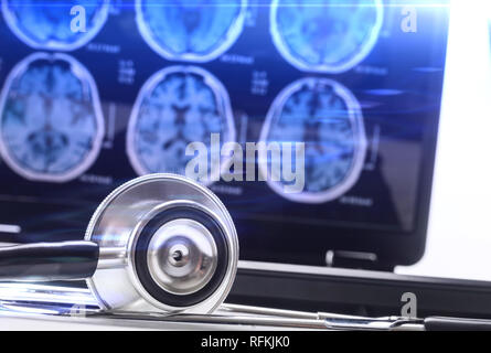 Stéthoscope à côté d'ordinateur avec les radiographies du cerveau, conceptual image Banque D'Images