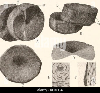 . Carnegie Institution of Washington publication. Les 188 MESURES DE CHARBON AMPHIBIA OF NORTH AMERICA. Diamètre de la proportion de i à 3. Les facettes articulaires sont profondément et terminal également ; mais concave du centre à la marge les surfaces sont convexes, et cette convexité est plus près du centre. * * * Les cavités pour la réception de l'affaire intervertébraux commencer immédiatement à partir de la marge, et sont beaucoup plus profonds que les parties correspondantes de l'Ichthyosaurus, indiquant une plus grande flexibilité au niveau de la colonne vertébrale. Les marges de la vertèbre ; sont quelque peu ra Banque D'Images