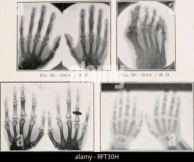 . Carnegie Institution of Washington publication. 7 PLAQUE DE FK ;. 50.-194.S d" H. 0 FK ;. 49.-194.S c ? II. O.. FIG. 51.-91942.1 J. G.. Veuillez noter que ces images sont extraites de la page numérisée des images qui peuvent avoir été retouchées numériquement pour plus de lisibilité - coloration et l'aspect de ces illustrations ne peut pas parfaitement ressembler à l'œuvre originale.. Carnegie Institution de Washington. Washington, Carnegie Institution of Washington Banque D'Images