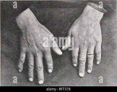 . Carnegie Institution of Washington publication. FIG. 25.-194,79 S. Une. FIG. 26.-194,79 S. A a,. Veuillez noter que ces images sont extraites de la page numérisée des images qui peuvent avoir été retouchées numériquement pour plus de lisibilité - coloration et l'aspect de ces illustrations ne peut pas parfaitement ressembler à l'œuvre originale.. Carnegie Institution de Washington. Washington, Carnegie Institution of Washington Banque D'Images