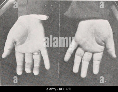 . Carnegie Institution of Washington publication. . FIG. 25.-194,79 S. Une. FIG. 26.-194,79 S. A a,. Veuillez noter que ces images sont extraites de la page numérisée des images qui peuvent avoir été retouchées numériquement pour plus de lisibilité - coloration et l'aspect de ces illustrations ne peut pas parfaitement ressembler à l'œuvre originale.. Carnegie Institution de Washington. Washington, Carnegie Institution of Washington Banque D'Images