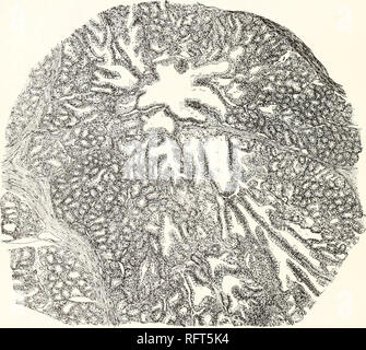 . Carnegie Institution of Washington publication. 22 LE VENIN DE HELODERMA. Comme déjà mentionné dans la section sur l'anatomie générale, l'ensemble de la glande est investi par une capsule de tissu fibreux. À partir de cette plusieurs septa relativement épais étendre vers l'intérieur, complètement divisant le presse-étoupe dans trois ou quatre pièces entièrement indépendant ou lobes. Chaque lobe est un sac en forme de poire. Le centre du bossage est occupé par un nombre relativement ample lumen, ce qui je le terme canal collecteur central. À son extrémité supérieure ceci rétrécit progressivement pour former le conduit excréteur, qui s'ouvre à l'apex de Banque D'Images