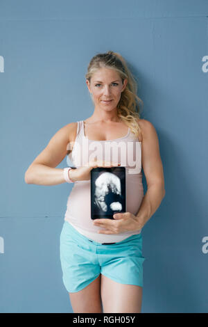 Portrait of smiling pregnant woman showing photo échographie sur tablette Banque D'Images