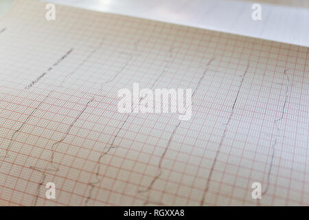 Vue rapprochée d'un papier de l'électrocardiogramme Banque D'Images