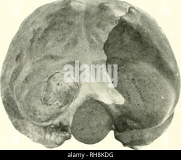 . Le cerveau de singe à l'homme ; une contribution à l'étude de l'évolution et le développement du cerveau humain. Cerveau ; évolution ; Pongidae. . Veuillez noter que ces images sont extraites de la page numérisée des images qui peuvent avoir été retouchées numériquement pour plus de lisibilité - coloration et l'aspect de ces illustrations ne peut pas parfaitement ressembler à l'œuvre originale.. Tilney, Frédéric, 1875-1938 ; Riley, Henry Alsop, 1887-. New York, P. B. Hoeber, inc. Banque D'Images