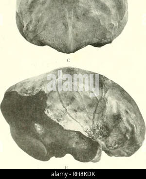 . Le cerveau de singe à l'homme ; une contribution à l'étude de l'évolution et le développement du cerveau humain. Cerveau ; évolution ; Pongidae. ^. Veuillez noter que ces images sont extraites de la page numérisée des images qui peuvent avoir été retouchées numériquement pour plus de lisibilité - coloration et l'aspect de ces illustrations ne peut pas parfaitement ressembler à l'œuvre originale.. Tilney, Frédéric, 1875-1938 ; Riley, Henry Alsop, 1887-. New York, P. B. Hoeber, inc. Banque D'Images