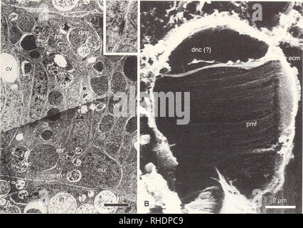 . Bonner zoologische Monographien. Zoologie. 27. Fig.11 : Les micrographies électroniques de cellules notocordes disparaissent. - Un aspect d'un TEM sagittale stade neurulation (30h pf, 18°C). En médaillon : jonction cellulaire (jonctions adherens type) entre deux centre de noto- par accord les cellules. B - micrographie SEM d'une fracture de l'étape larvaire (1 pf lOh, 18°C). cv - vacuole centrale, dnc - cellules notocordes dorsale, ecm - matrice extracellulaire, dans l'intestin, - nt - neu- ral, tube nu - nucleus, pmf - filaments paramyosine, rer - de l'ergastoplasme, vnc - ventrale des cellules notocordes, yv - granule jaune. les sont présents parmi les cellules notocordes centrale Banque D'Images