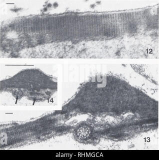 . Le bulletin biologique. Biologie ; zoologie ; biologie ; biologie marine. 13 Figure 10. Une coupe transversale de la base du pic de spermatozoïdes démontre la croix légèrement comprimé (stries en raison de l'angle de l'article) de la fibrilles radiales anastomosées. Bar  = 0,1 /im. La figure 11. À l'extrémité de l'épi révèlent les sections structures microtubulaires (flèche) en section transversale. Des structures similaires n'ont pas été observés dans les sections longitudinales. Bar  = 0,1 /*m. La figure 12. Les fibrilles radiales de la région de Cap-comme la base montrent la même apparence striée et présence de 6 nm filament Banque D'Images