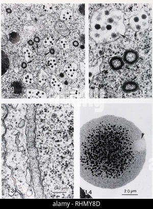 . Le bulletin biologique. Biologie ; zoologie ; biologie ; biologie marine. La figure 11. La fin de l'oocyle viteilus avec vésicules corticales primaires (PV) distincte de vésicules corticales secondaires (SV). M, mitochondrie. La figure 12. Fort agrandissement montrant la structure du PV (primaire) et secondaire (Sv) vésicules corticales. La figure 13. L'ovule (OI) de l'ovocyte mature dans l'oviducte de femmes couvertes par l'enveloppe vitelline (*). De cellules folliculaires. Fc ; Oo, ooplasm. La figure 14. Micrograph Light, 1-^m d'épaisseur de la section d'oeufs pondus récemment et formation de premier globule polaire (flèche). Note de l'établissement situé à granules vitellines avec Banque D'Images