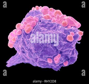 Lymphome cancer cell, SEM Banque D'Images