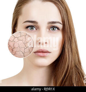 Cercle zoom montre la peau du visage sèche avant de mouiller. Banque D'Images