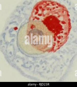 . Centralblatt für Infektionskrankheiten und Parasitenkunde Bakteriologie,. La bactériologie, la parasitologie, les maladies transmissibles, de la microbiologie médicale, la bactériologie, les maladies transmissibles ; microbiologie ; Parasitologie. 38. Veuillez noter que ces images sont extraites de la page numérisée des images qui peuvent avoir été retouchées numériquement pour plus de lisibilité - coloration et l'aspect de ces illustrations ne peut pas parfaitement ressembler à l'œuvre originale.. Jena. Jena : G. Fischer Banque D'Images