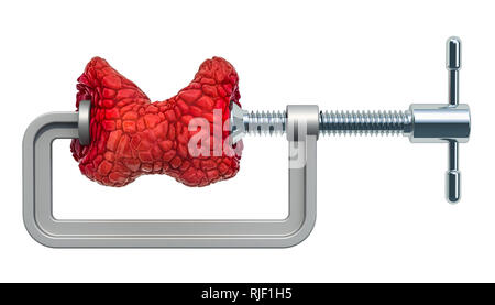 La maladie thyroïde concept. Les droits de l'étau avec la thyroïde, le rendu 3D isolé sur fond blanc Banque D'Images