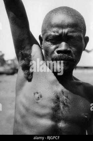 L'Afrique, Congo belge, en particulier l'aisselle poilue épais et durs des Pygmées, 1927-30 Banque D'Images