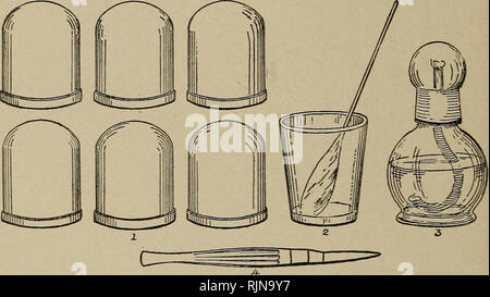 . Bactériologie et des techniques chirurgicales pour les infirmières. Soins infirmiers ; opérations chirurgicales, la chirurgie, la bactériologie. 220 verres à dégustation technique chirurgicale ou wineglasses. L'air d'échappement en brûlant un peu de rouleau de papier, morceau de papier non pelucheux, ou trempé dans l'alcool et s'est allumé. La flamme s'éteint avant de retourner rapidement le verre sur la surface de la peau. 2. Cuvettes humides.-(a) préparer la peau par nettoyer avec du savon et de l'eau, bien les sécher et appliquer à sec ; (b) avec un bistouri scarifier ou au moyen d'un ressort sur la cuvette scarificator sites ; (c) de nouveau les tasses. Fig. 179.-Instruments pour les ventouses : 1, C Banque D'Images