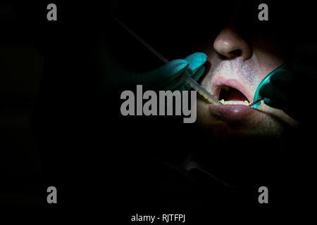 Les détails avec les mains d'une femme dentiste, avec des gants chirurgicaux, l'injection de plasma du sang dans les gencives d'un patient Banque D'Images