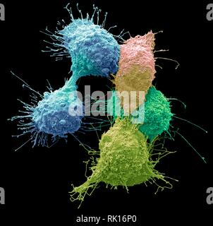 Les cellules du cancer de l'ovaire, SEM Banque D'Images
