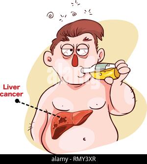 Homme qui boit de l'alcool et a le cancer (illustration) Illustration de Vecteur