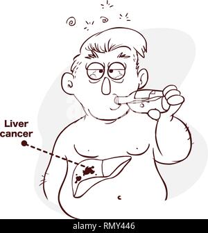 Homme qui boit de l'alcool et a le cancer (illustration) Illustration de Vecteur