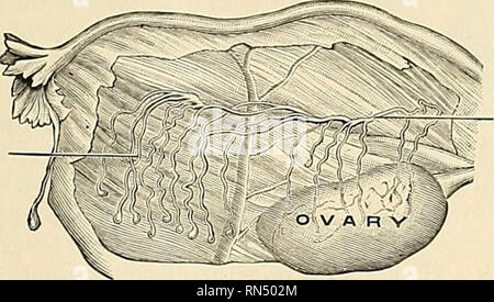 . Anatomie, descriptif et appliquée. L'anatomie. L'UTÉRUS, utérus OB 1405 couvre la face postérieure de la plupart des formulaires de la paroi antérieure de Douglas, cul-de-sac (fig. 1181 et 1182, et p. 1407). Ses marges latérales (Fig. 1178 et 1181) sont légèrement convexes. À l'angle supérieur de la trompe se joint au corps de l'utérus ; juste au-dessous de ce ligament rond est joint, et être- hind ce dernier est l'attachement du ligament de l'ovaire ; derrière les deux. Fig. 1180.-l'parovarium. Le mesoaalpinx est partiellement éliminée. (Poirier et essai charpy.) ces structures, et du côté de l'utérus la Banque D'Images