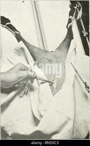 . La castration des animaux. La castration. La castration des animaux 108. La SIF ?. 18-INCISION MÉDIANE MONTRANT, IMMÉDIATEMENT EN ARRIÈRE DE L'ombilic. Veuillez noter que ces images sont extraites de la page numérisée des images qui peuvent avoir été retouchées numériquement pour plus de lisibilité - coloration et l'aspect de ces illustrations ne peut pas parfaitement ressembler à l'œuvre originale.. Lacroix, Jean Victor, 1882-. Chicago, American Journal of veterinary medicine Banque D'Images