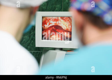 Les neurochirurgiens observer la chirurgie du cerveau dans un moniteur Banque D'Images