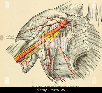 . Anatomie, descriptif et appliquée. L'anatomie. L'artère axillaire après 635 s'étendant dans le cou, a été connu pour se propager à travers le suiicrior ojjcning du thorax dans le médiastin. Dans l'ouverture d'un abcès axillaire le couteau doit être inscrite dans le marbre de l'aisselle, à mi-chemin entre la partie antérieure et postérieure des marges et à proximité de la côté thoracique de l'espace. Il est bien d'utiliser une pince à pansement et directeur après une incision a été faite par la peau et le fascia de la manière ordonnée par feu M. Hilton. Les relations des vaisseaux et des nerfs dans les diverses parties de l'axill Banque D'Images