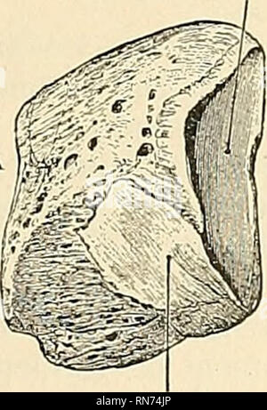 . Anatomie, descriptif et appliquée. L'anatomie. Fig. 197 -Le scaphoïde gauche pour voir l'éternelle de tubercule d'astragale. B. postero-vue intérieure. Pour ForZnd pour 1er métatarse métatarse la mi-cuneiform de déterminer à qui appartient l'os du pied, tenez-le" avec la surface articulaire concave en arrière- ward, et la surface dorsale convexe vers le haut ; la surface externe-i. e., la surface en face de l'bacille-pointe vers le côté où l'os appartient. Articulations.-avec quatre os-astragalus et trois tablettes cunéiformes ; parfois aussi avec le cuboïde. Fixation des muscles.-Une partie de l'posticus tibialis. Banque D'Images