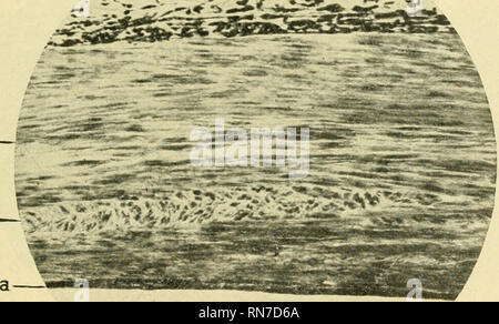 . Anatomischer Anzeiger. L'anatomie, l'Anatomie Comparée ;, comparatif. 257 dans le cordon ombilical et d'autres artères, les fibres musculaires longitudinales se produisent dans l'adventice. Mais à de rares exceptions près l'on enseigne que les médias propre est composé entièrement d'éléments musculaires disposé transversalement. Nous avons été en mesure d'obtenir l'origmal du professeur Karl V. Bardeleben (o) observations il y a si longtemps que 1878, et sont donc en mesure d'indiquer précisément l'arrangement des fibres musculaires obliques noté par lui. J'espère qu'il sera aussi bon que pour ajouter une courte note l'annexe à la présente communication rappelant ces premiers Banque D'Images