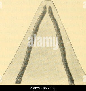 . Anatomischer Anzeiger. L'anatomie, l'Anatomie Comparée ;, comparatif. Abb. 16. Abb. 15.. Veuillez noter que ces images sont extraites de la page numérisée des images qui peuvent avoir été retouchées numériquement pour plus de lisibilité - coloration et l'aspect de ces illustrations ne peut pas parfaitement ressembler à l'œuvre originale.. Anatomische Gesellschaft. Jena : G. Fischer Banque D'Images