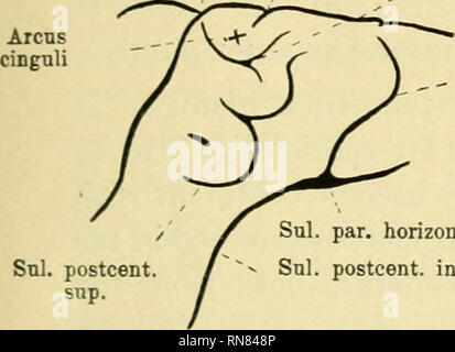 . Anatomischer Anzeiger. L'anatomie, l'Anatomie Comparée ;, comparatif. 93 l'arcus est délimitée par un sillon qui varie en profondeur et en définition avec la taille de l'godronné qui elle limite. Cette dernière pourrait bien être appelé le sillon le sillon para-cinguli. Mais ce sillon occupe une position telle que l'anastomose avec post-supérieure le sillon central est presque inévitable et, en fait, cette union se produit très souvent en effet. Les deux sillons peuvent être tout à fait séparés (Fig. 1. A.) ou, plus généralement, ils s'unir. De cette manière toutes sortes de SNL. centralis Sul. cingnli paracingnli. Sol , - Sul. Banque D'Images