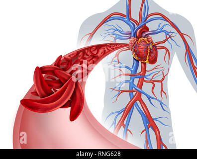 La drépanocytose anémie et blocage de la circulation du cœur comme une maladie avec l'hémoglobine normale et anormale dans une artère de l'anatomie à coeur. Banque D'Images